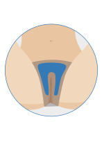 Below view of basic bikini wax