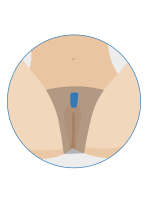 Below view of brazilian wax